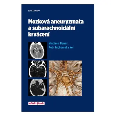 Mozková aneurysmata a subarachnoidální krvácení - Vladimír Beneš