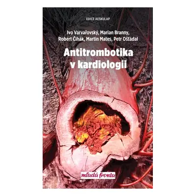 Antitrombotika v kardiologii - Ivo Varvařovský