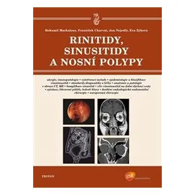 Rinitidy, sinusitidy a nosní polypy - Bohumil Markalous