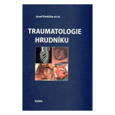 Traumatologie hrudníku - Josef Vodička