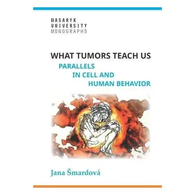 What tumors teach us - Parallels in cell and human behavior - Jana Šmardová