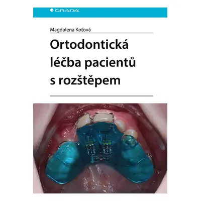 Ortodontická léčba pacientů s rozštěpem - Magdalena Koťová