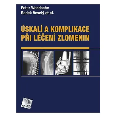 Úskalí a komplikace při léčení zlomenin - Peter Wendsche