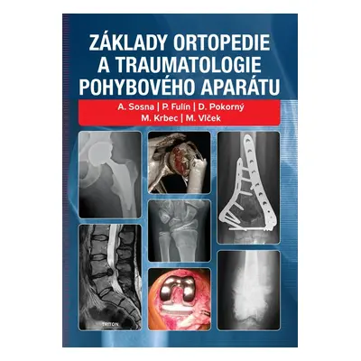 Základy ortopedie a traumatologie pohybového aparátu - Antonín Sosna