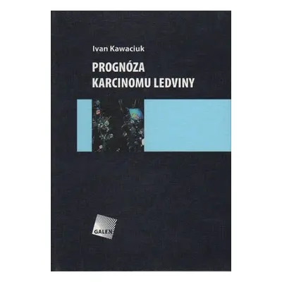 Prognóza karcinomu ledviny - Ivan Kawaciuk