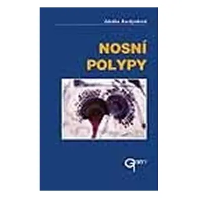 Nosní polypy - Zdeňka Kuchynková