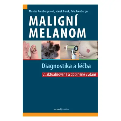 Maligní melanom - Diagnostika a léčba, 2. vydání - Monika Arenbergerová