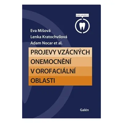 Projevy vzácných onemocnění v orofaciální oblasti - Eva Míšová