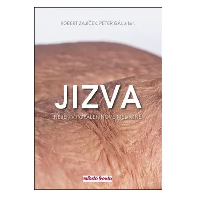 Jizva nejen v popáleninové medicíně - Peter Gál