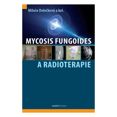 Mycosis fungoides a radioterapie - kolektiv autorů