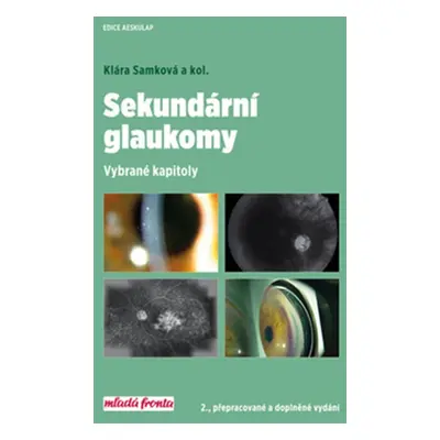 Sekundární glaukomy - Vybrané kapitoly, 2. vydání - Klára Samková