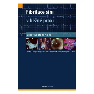 Fibrilace síní v běžné praxi - Josef Kautzner