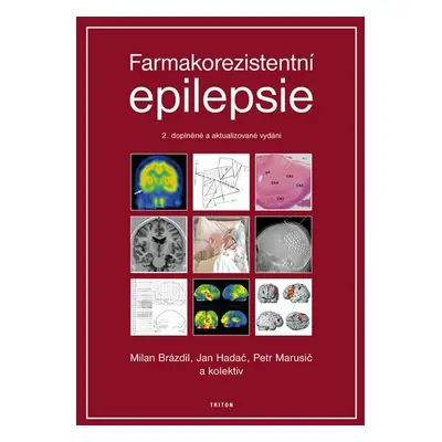 Farmakorezistentni epilepsie - 2. vydání - Milan Brázdil