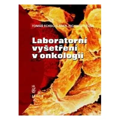 Laboratorní vyšetření v onkologii - Tomáš Eckschlager