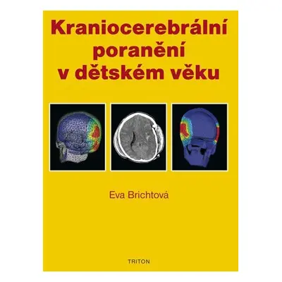 Kraniocerebrální poranění v dětském věku - Eva Brichtová