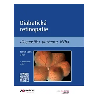 Diabetická retinopatie - Diagnostika, prevence, léčba - Tomáš Sosna