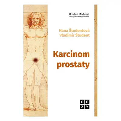 Karcinom prostaty - Hana Študentová