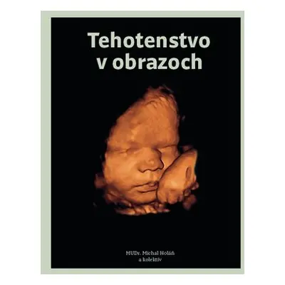 Tehotenstvo v obrazoch - Michal Holáň