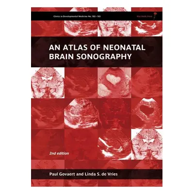 An Atlas of Neonatal Brain Sonography - Paul Govaert