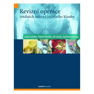 Revizní operace totálních náhrad kyčelního kloubu - kolektiv autorů