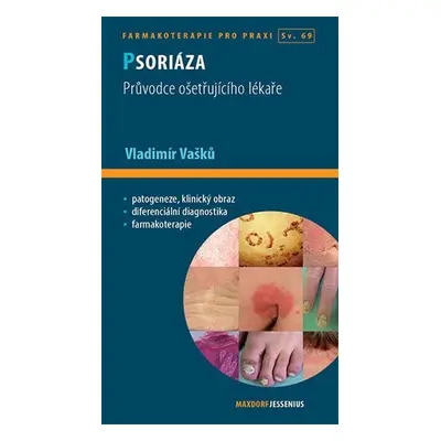 Psoriáza - Průvodce ošetřujícího lékaře, 1. vydání - Vladimír Vašků