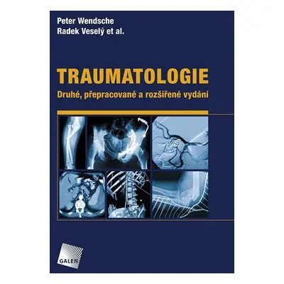 Traumatologie - Peter Wendsche