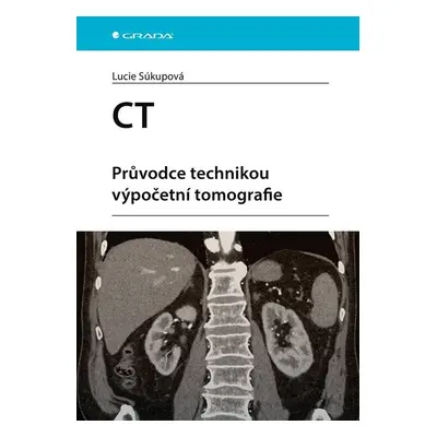 CT - Průvodce technikou výpočetní tomografie - Lucie Súkupová