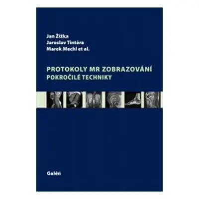 Protokoly MR zobrazování - pokročilé techniky - Marek Mechl