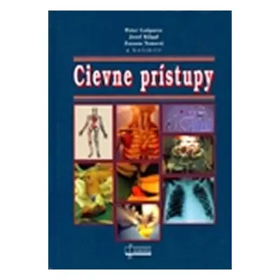 Cievne prístupy - Peter Gašparec