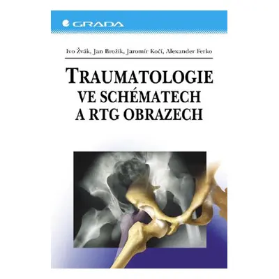 Traumatologie ve schématech a RTG obrazech - Jaromír Kočí