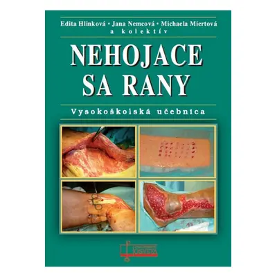 Nehojace sa rany - Michaela Miertová