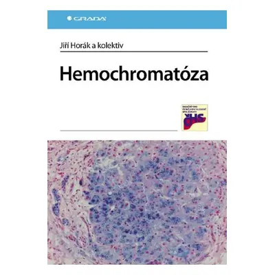 Hemochromatóza - kolektiv a