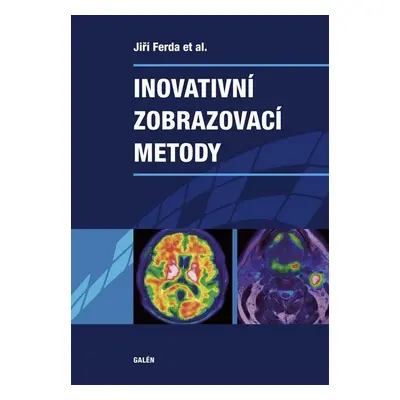 Inovativní zobrazovací metody - Jiří Ferda