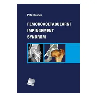 Femoroacetabulární impingement syndrom - Petr Chládek