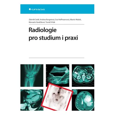 Radiologie pro studium i praxi - Eva Hoffmannová