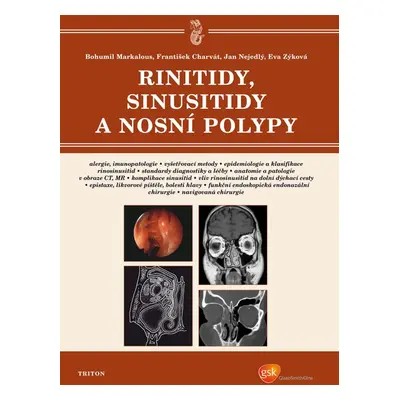 Rinitidy, sinusitidy a nosní polypy - František Charvát