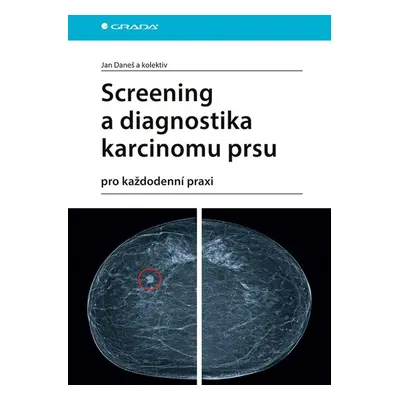 Screening a diagnostika karcinomu prsu - Jan Daneš