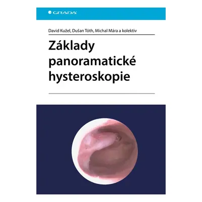 Základy panoramatické hysteroskopie - Dušan Tóth