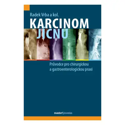 Karcinom jícnu - Radek Vrba