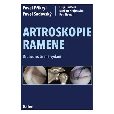 Artroskopie ramene - Pavel Sadovský