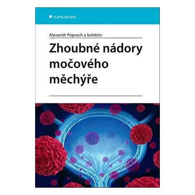 Zhoubné nádory močového měchýře - Alexandr Poprach