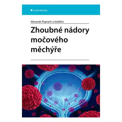 Zhoubné nádory močového měchýře - Alexandr Poprach