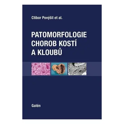 Patomorfologie chorob kostí a kloubů - Ctibor Povýšil