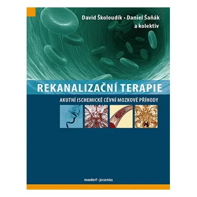 Rekanalizační terapie - David Školoudík