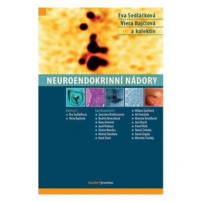 Neuroendokrinní nádory - Eva Sedláčková