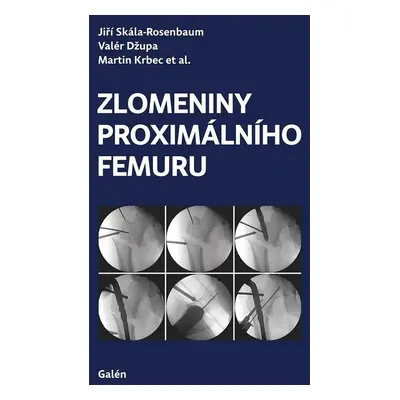 Zlomeniny proximálního femuru - Martin Krbec