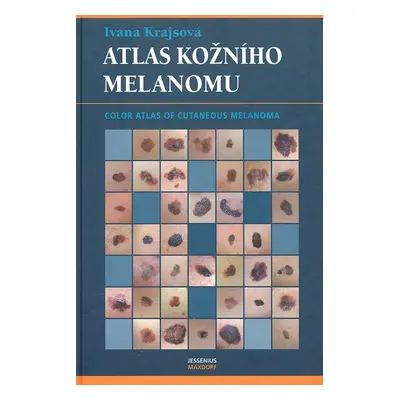 Atlas kožního melanomu - Ivana Krajsová