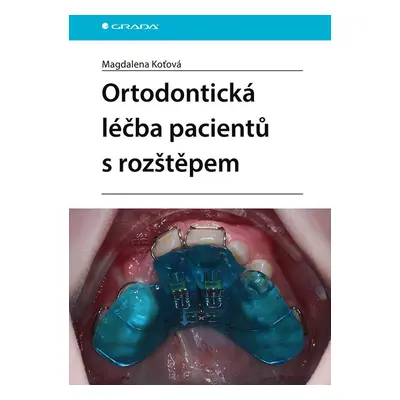 Ortodontická léčba pacientů s rozštěpem - Magdalena Koťová