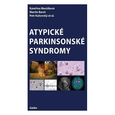 Atypické parkinsonské syndromy - Petr Kaňovský