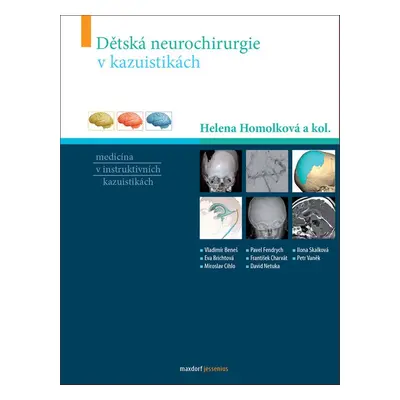 Dětská neurochirurgie v kazuistikách - Helena Homolková